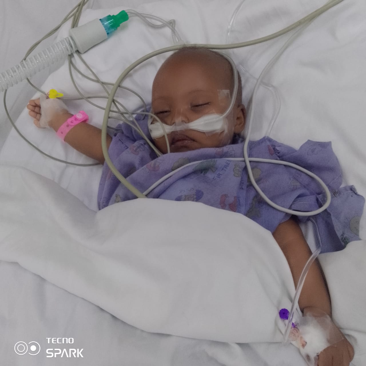 AMELIAH CHEROTICH’S RACE FOR LIFE: A FAMILY’S DESPERATE CRY FOR HELP 🙏